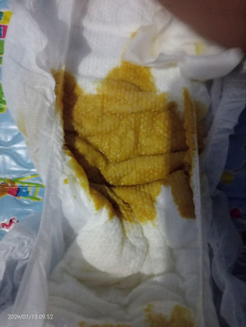 Dumi nang 5months baby ko.