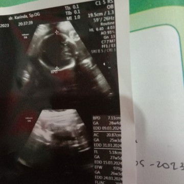 Perut 7 bulan terlihat kecil