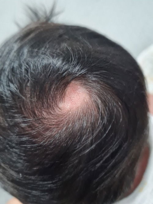 มีแม่ๆท่านไหนเคยเจอบ้างคะ