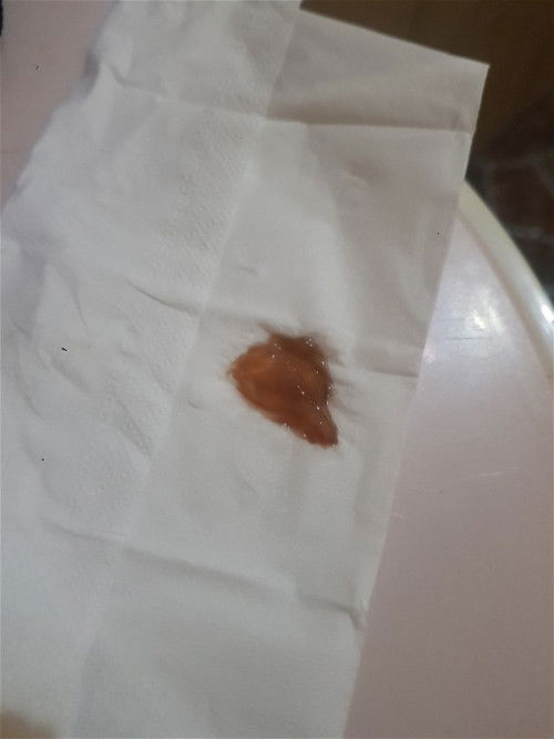 Hpl 17 jan hari ini keluar lendir jelly coklat gini, biasanya berapa hari dari lahiran ya?