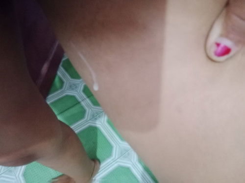 Keluar cairan putih susu