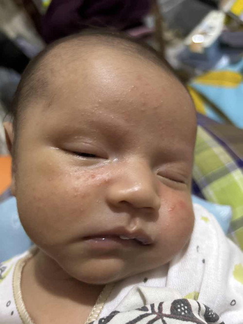 Muka bintik merah