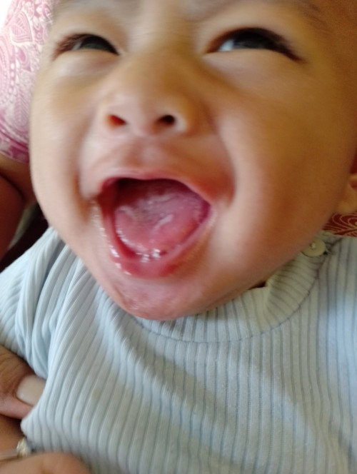 Lidah ada bercak putih