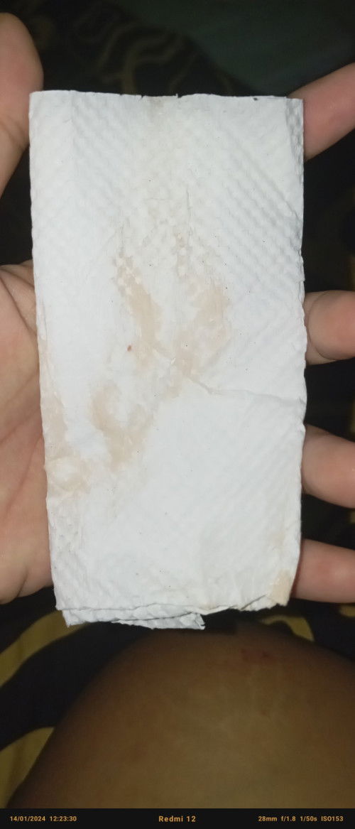 Keluar cairan dari anus