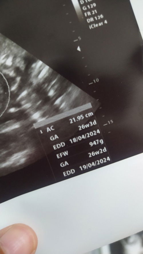 Hasil USG 26week