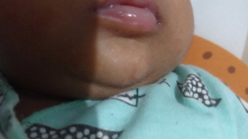 Penyakit kulit