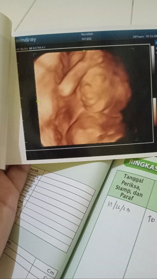 HASIL USG 4d