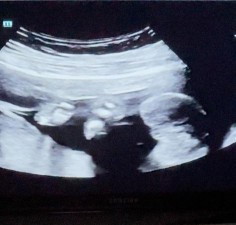Nak tanya agak2 ni baby boy ke baby girl..