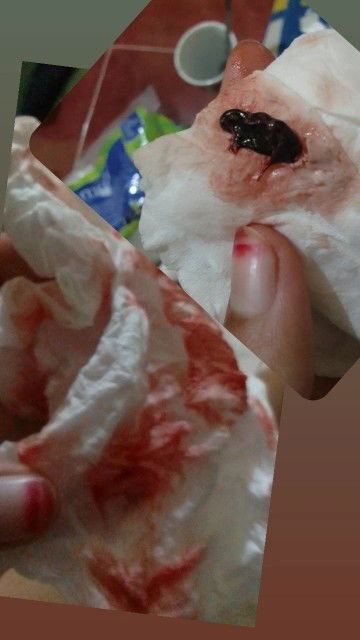 Cerita selalu kelur darah dari awal Sampek 18 minggu