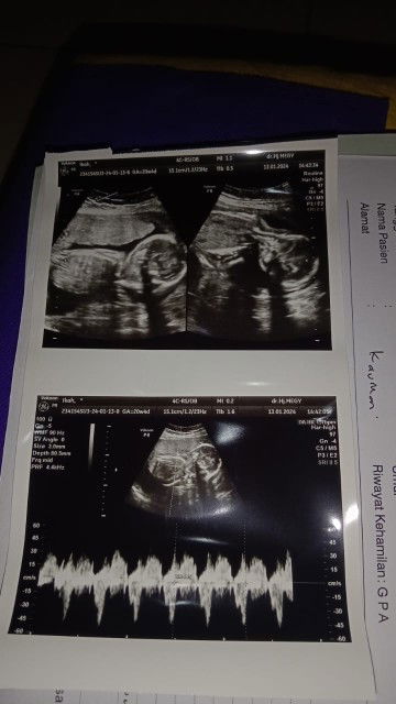 Bund.ini gpp gk sih.