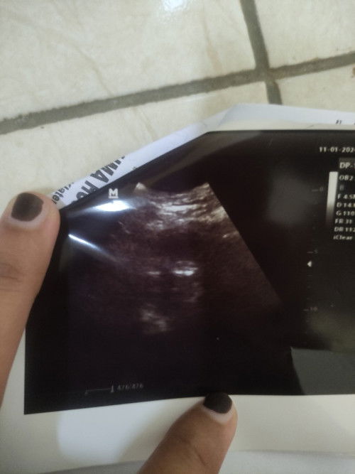 bu ibu maaf mau nanya saya udah telat hampir 2 bulan dites positif tpi pas usg janin belum kelihatan