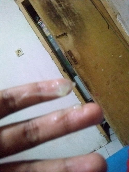 Keluar lendir putih kental