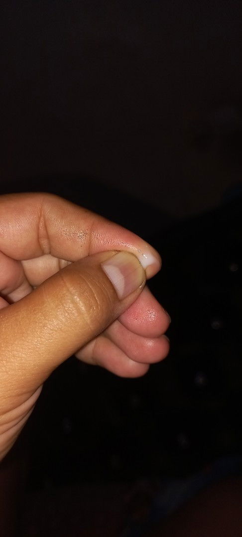 Bun hamil trimester 3 ,terkadang mengalami keputihan ,wajar ndak ya bun.?