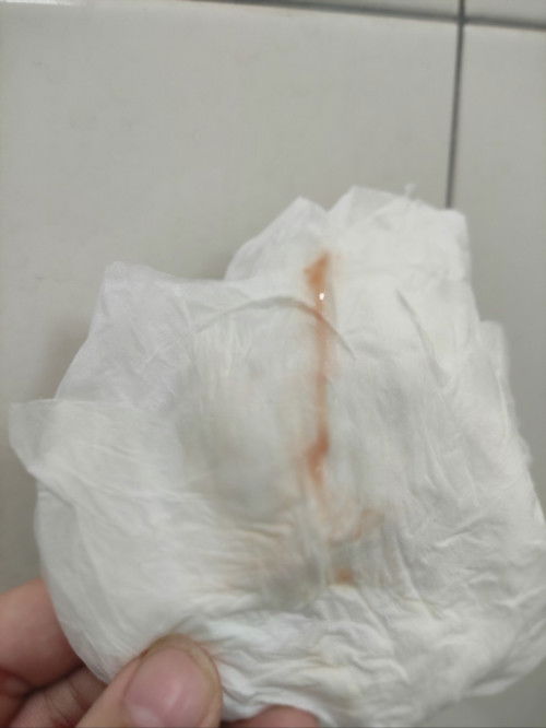 Hamil 7w keluar lendir warna pink