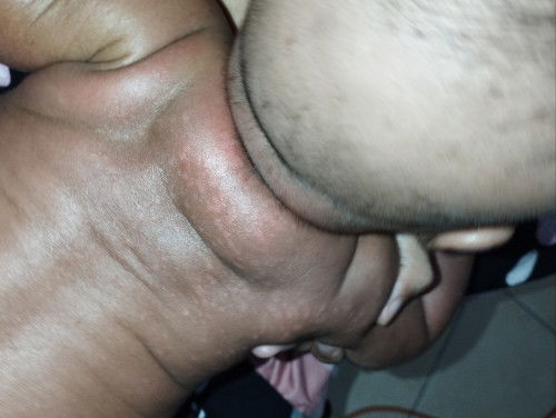 Badan seperti panuan