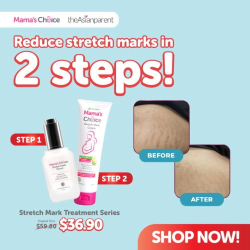 With only 2 STEPS, You Can Say Goodbye to Stretch Marks! 😍
