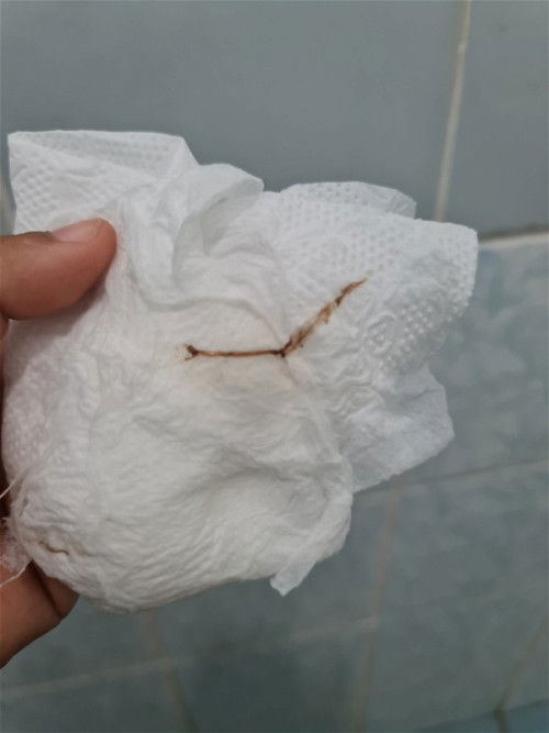 สอบถามค่ะ แม่ๆคนไหนมีประสบการณ์แบบนี้บ้างคะ