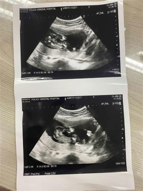 แบบนี้น้องเป็น ผญ หรือ ผช ค่าา