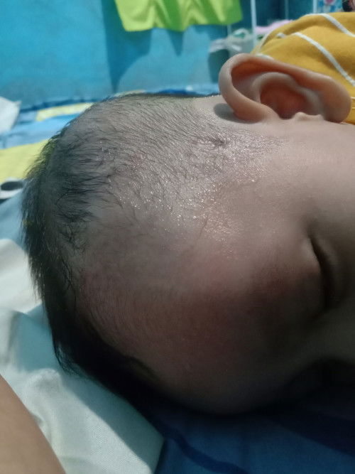 Kepala bayi berkeringat