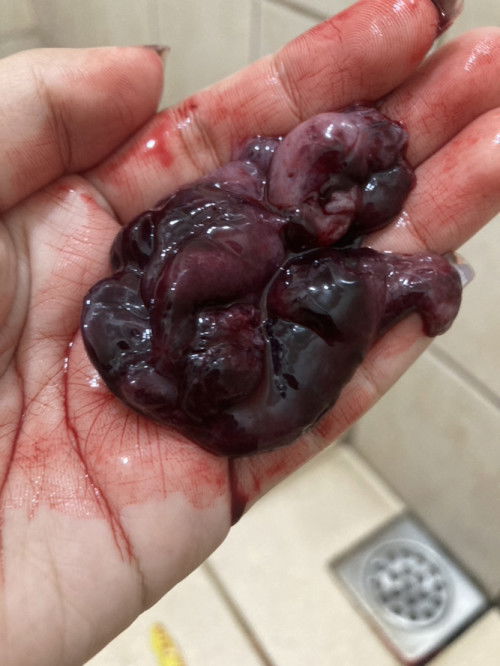 Mag 4months na si baby sa Jan27