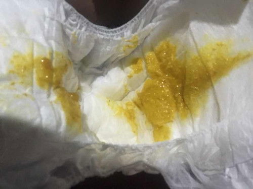 Anakku umur 1 bulan sering BAB ngulet dikit keluar eek kentut juga keluar eek