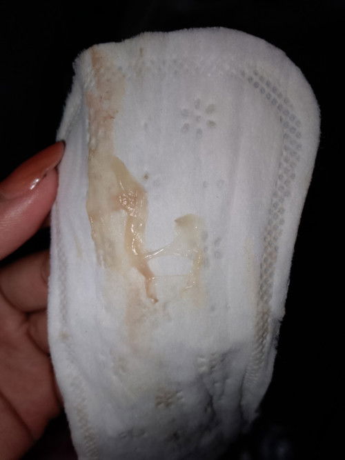 Mucus Plug 37weeks and 1 day