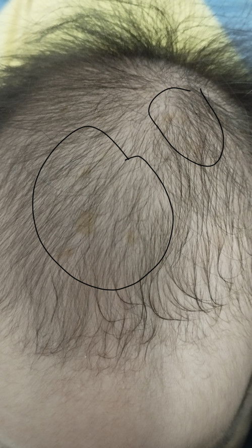 Cho em hỏi đốm này có phải cứt trâu không các mom?