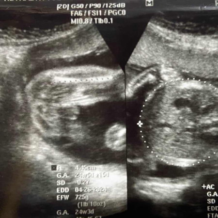 Sa tingin nyo po boy o girl? Kase panganay ko po ay boy. 6 months preggy po ako 🥰