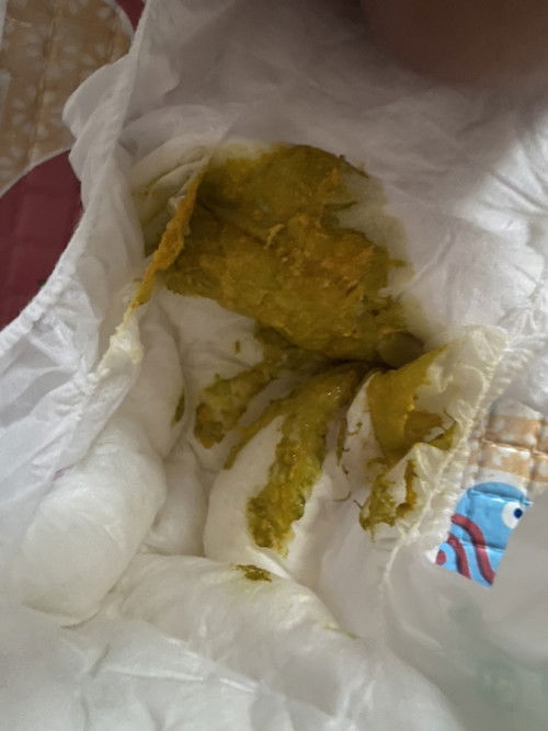 Warna pup bayi kuning kehijauan