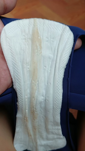 Discharge during pregnant