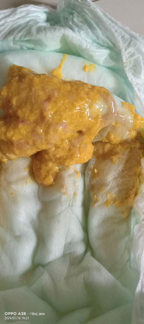 hello po mga mommy normal ba ito na popo?