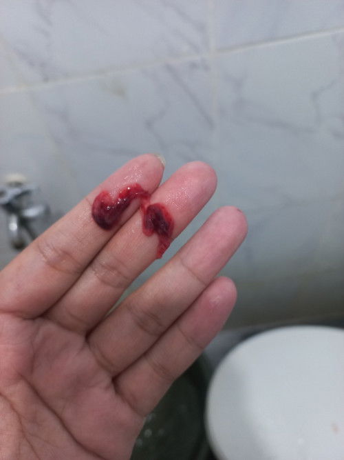 ini darah haid atau apa ya?