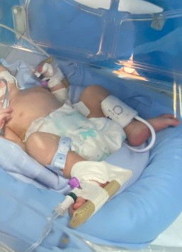 Bayi baru lahirku lagi di NICU udah 5 hari, mohon doanya agar segera sehat bun🥺😭🙏