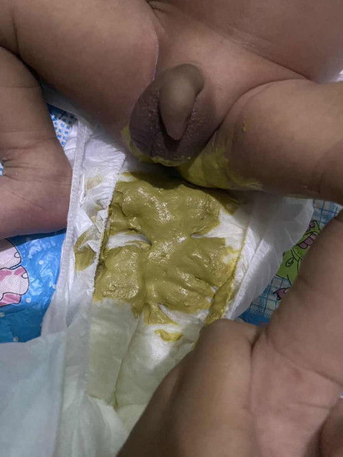 PUP bayi asi mix sufor