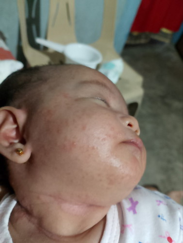 Kusa po bang nawawala ito?