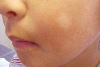 Panu/apa saya ga tau