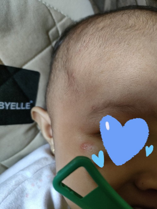 Samping mata anak merah dan bintik² kecil