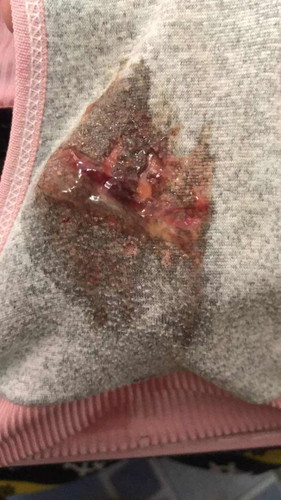 40สัปดาห์  เมื่อวานโดนกระตุ้น