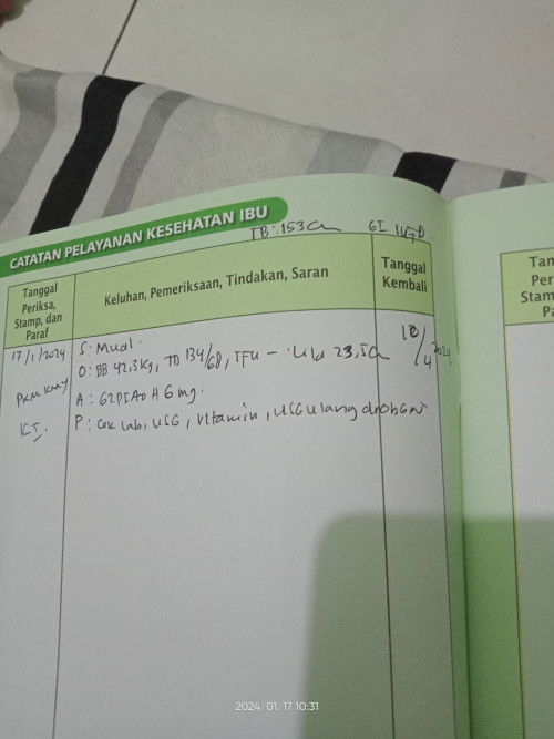 Bunda bunda kalo boleh tau periksa hamil nya berapa bulan sekali?