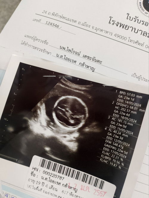 ดูไม่เป็นค่ะ