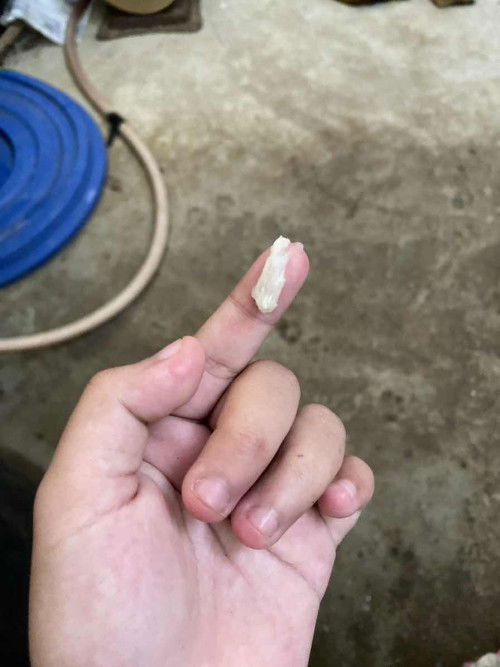 แบบนี้ช่มูกใสมั้ยเหนียวๆเป็นก้อนๆไม่ติดมือ