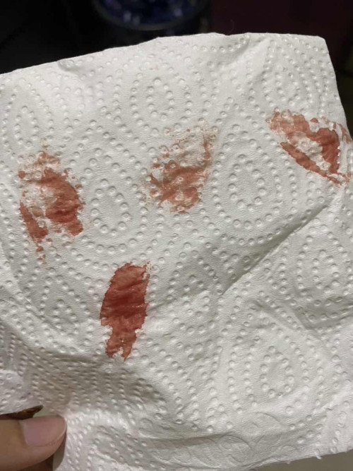 Normal atau tak?