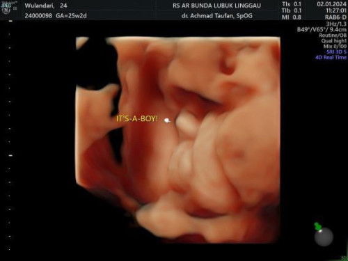 normal ga ya bbj ny?