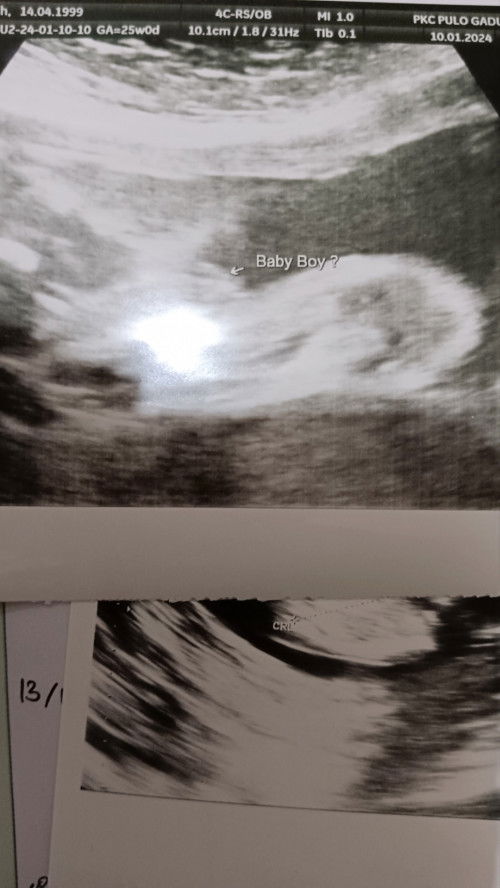 jenis kelamin masih tanda tanya?