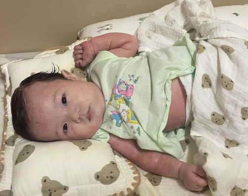 น้องผิวแห้งมากเลยค่ะ  แม่เริ่มเครียด ใช้ครีมมาทุกยี่ห้อไม่ดีขึ้น 😭