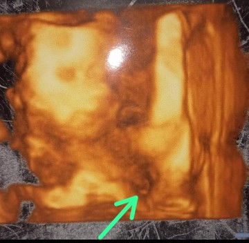 Bun ini kalo dilihat JK nya cewek atau cowok y ,soalnya digmbar GK jelas bentuknya? Sharing dong bun