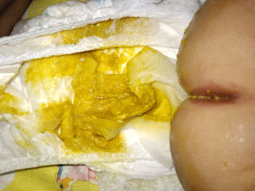 Bayi diare apa bukan ?