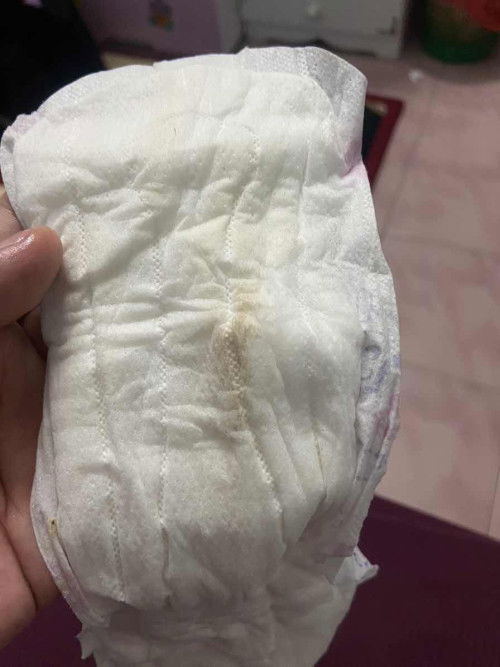 33 minggu kluar spotting