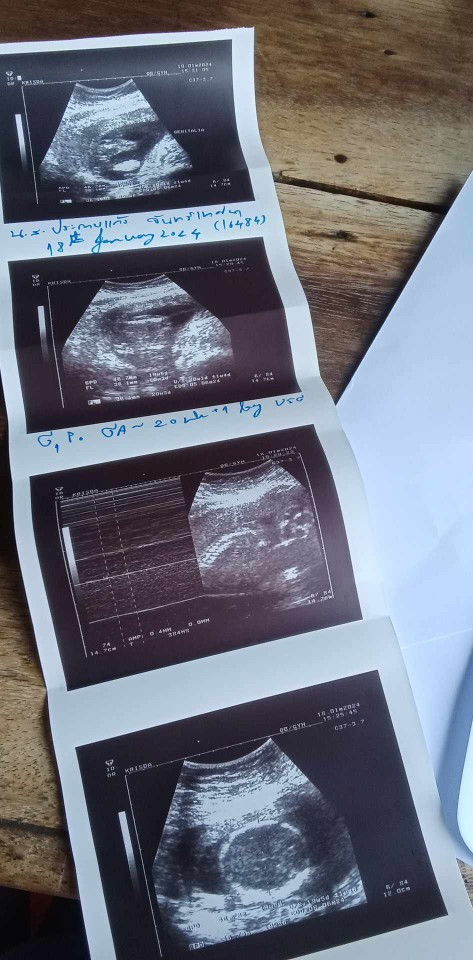 แบบนี้ดูน้ำหนักตรงไหนหรอคะแม่ๆ