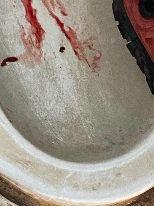 มีเลือดออกควรไปร.พไหมคะแบบนี้